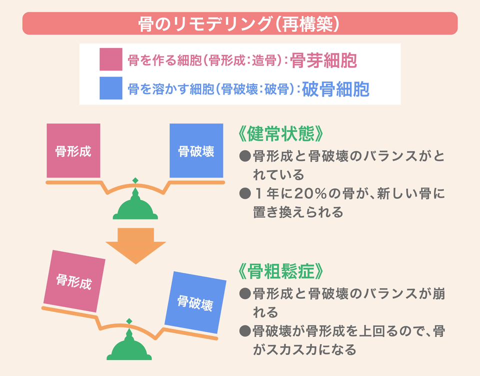 骨のリモデリング（再構築）