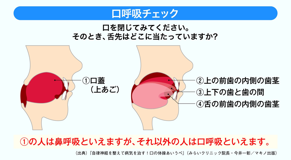 口呼吸チェック